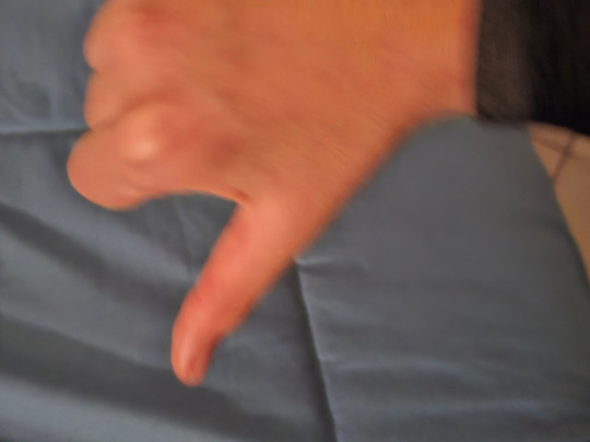 Albergo Ristorante La Noce主图