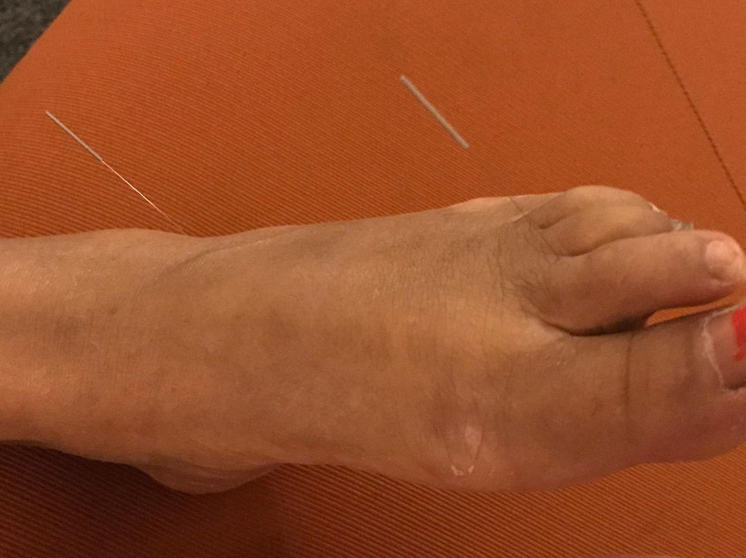 Community Acupuncture Project of Burien-Burien必去景点