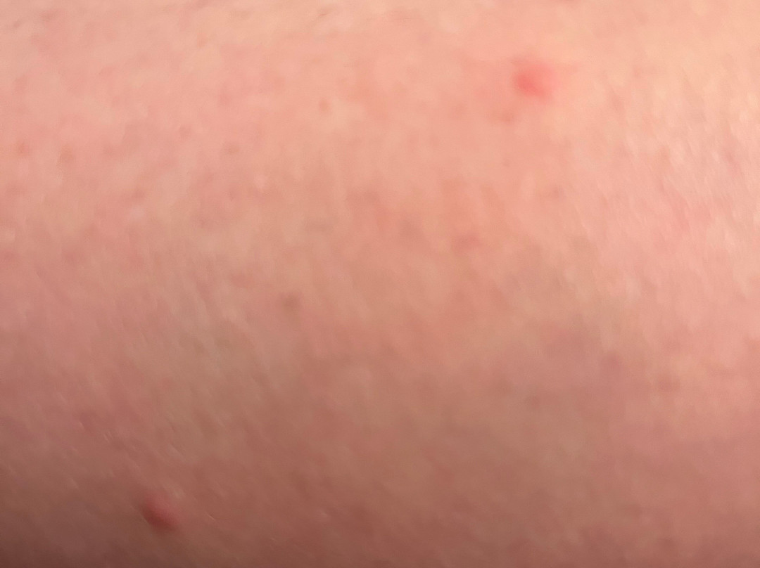 Candlewood Suites Boston North Shore - Danvers by IHG主图