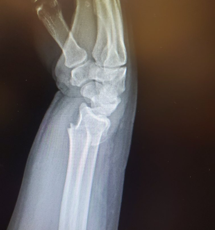 Elk River Floats & Kozy Kamp-Pineville必去景点