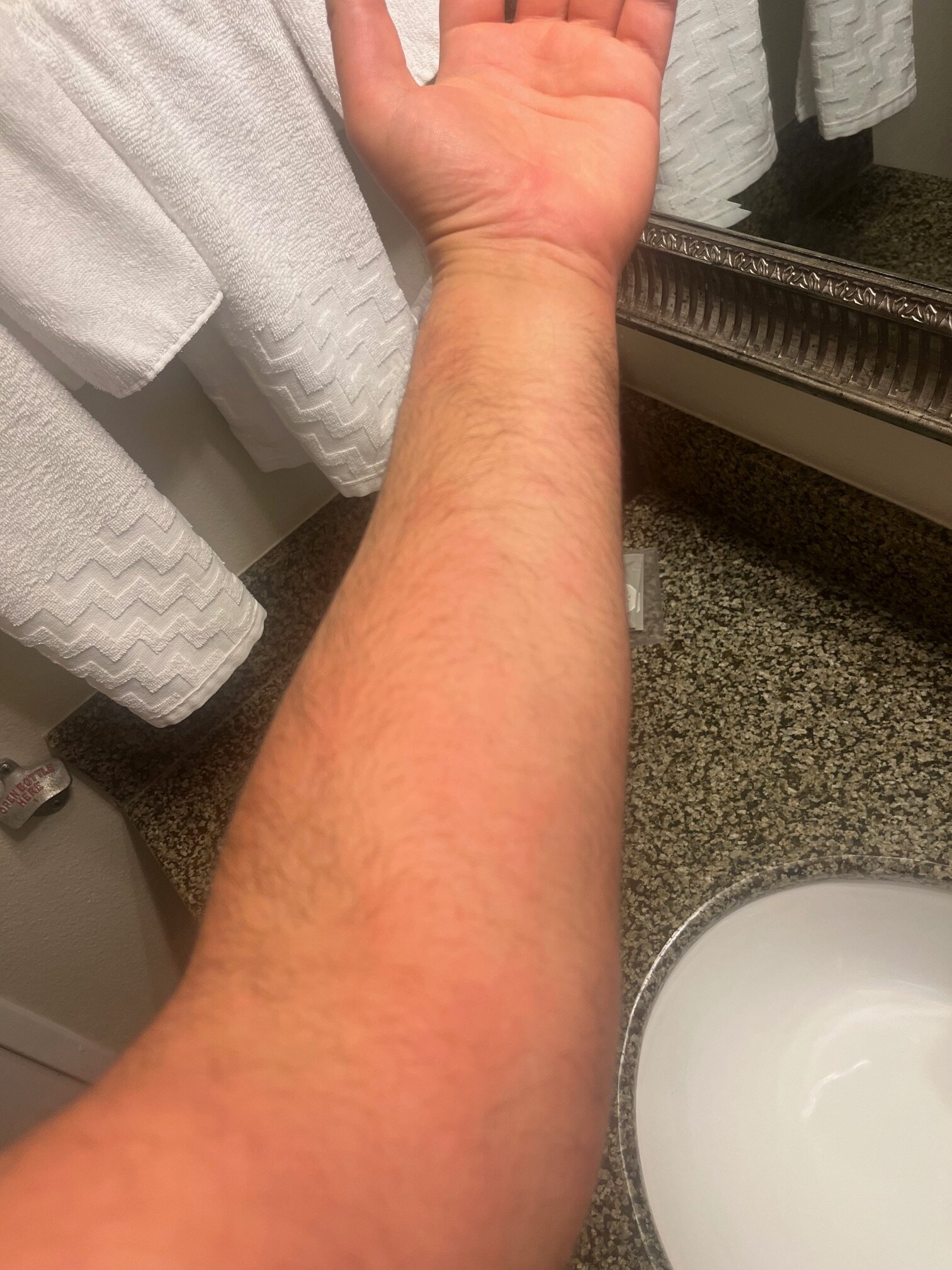 卡拉巴萨斯美好夜间旅馆-客卧