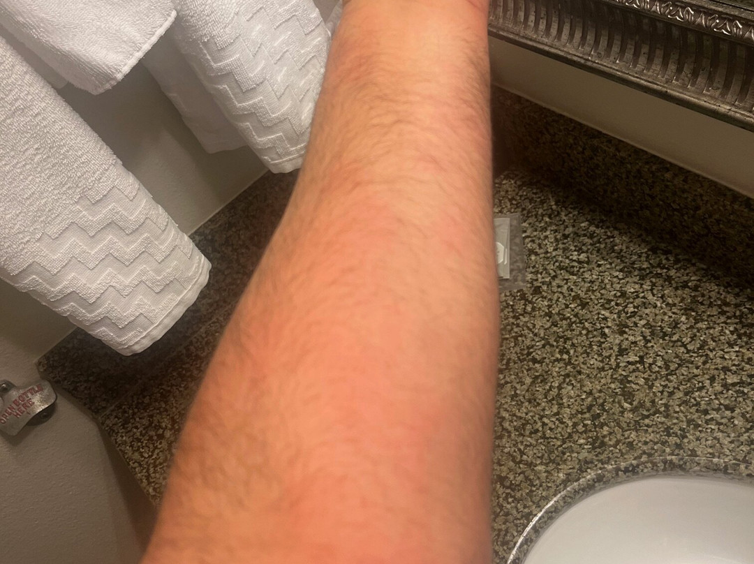 卡拉巴萨斯美好夜间旅馆主图