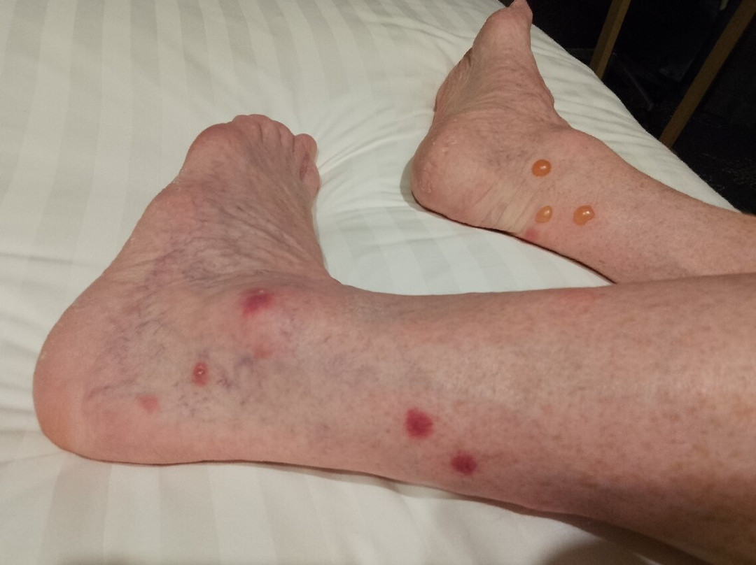 道格拉斯自由港酒店主图