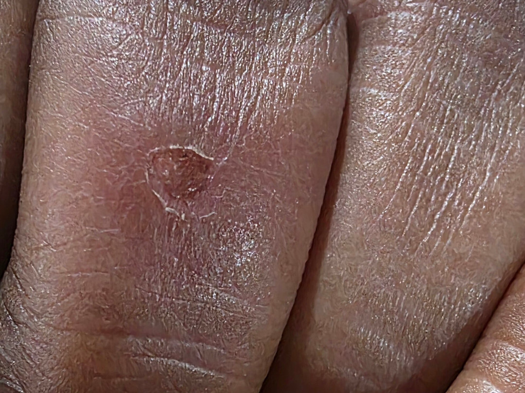 The Palms At Coco Beach主图