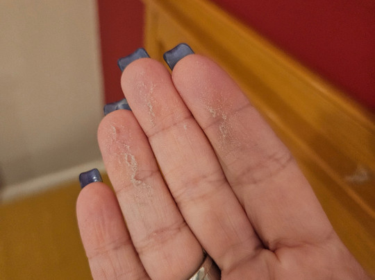 Royal Exeter Hotel主图