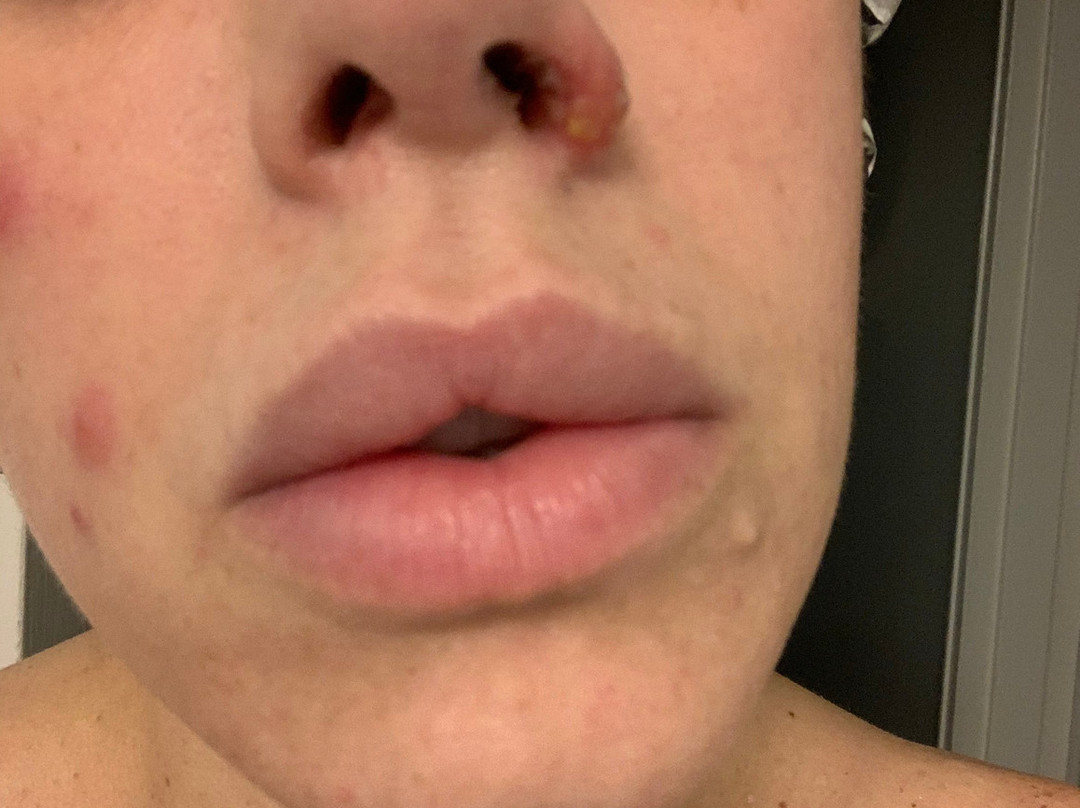 Simply Skin-汤姆斯河必去景点