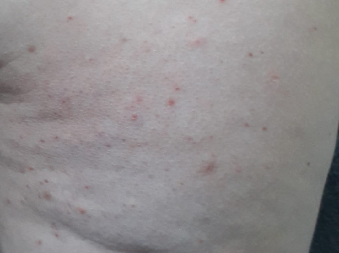 The Lemon Tree Hotel