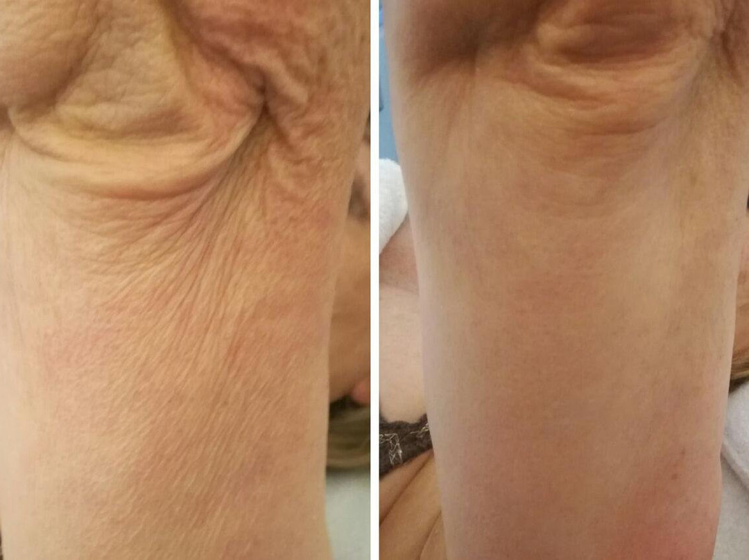 Diminish Face and Body Sculpting Clinic-西索美塞必去景点