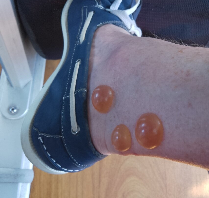 道格拉斯自由港酒店主图