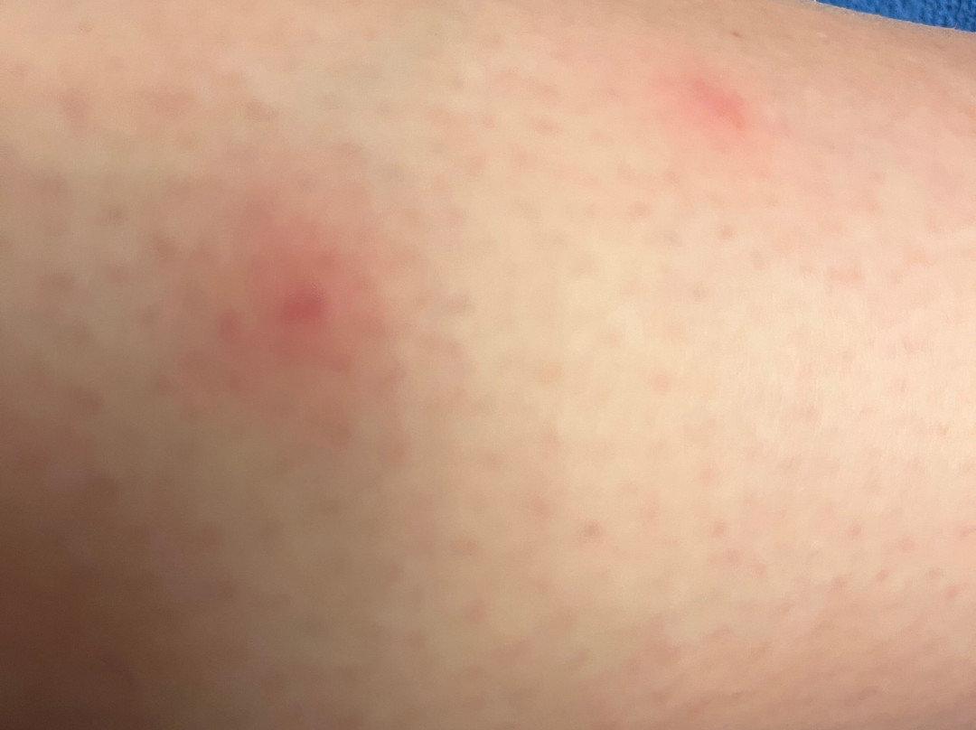 Candlewood Suites Boston North Shore - Danvers by IHG主图