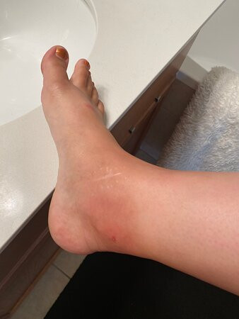 Ocean's Edge Hotel, Port Aransas TX主图