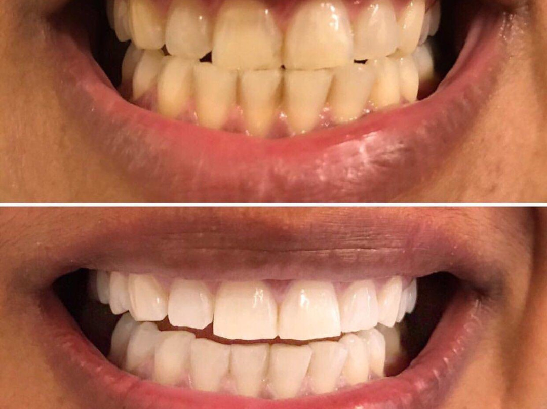 Spa Mosman-莫斯曼必去景点