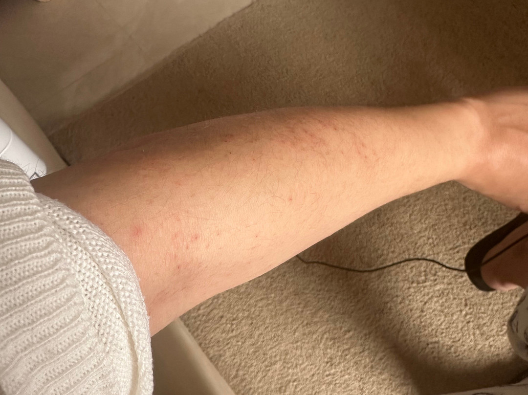 宜必思埃尔加迪达酒店主图