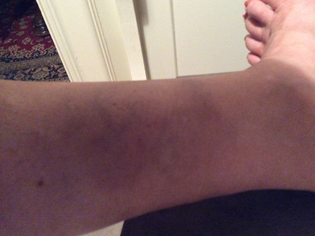 Butterfly World and the Boardwalk-蒙古顿必去景点