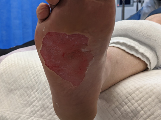 Yongala Dive-Ayr必去景点