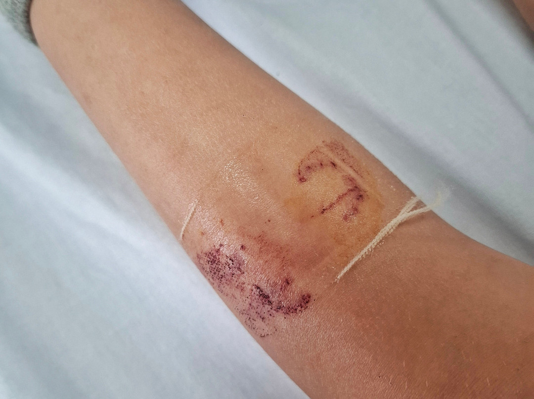 Red Zoo-平贾拉必去景点