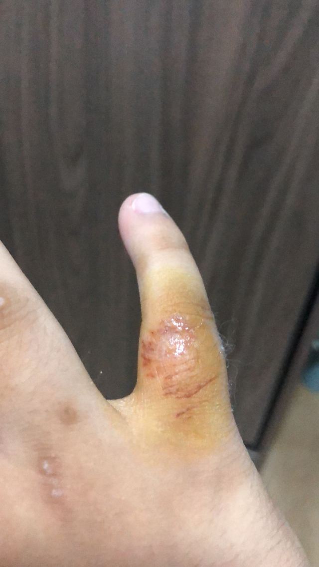 枫香温泉度假中心旅行图片 4