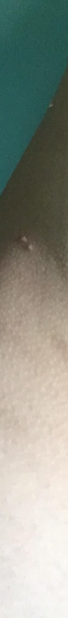 Tingko Beach-阿尔科伊