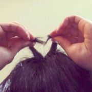 腰间盘突出的治疗方法